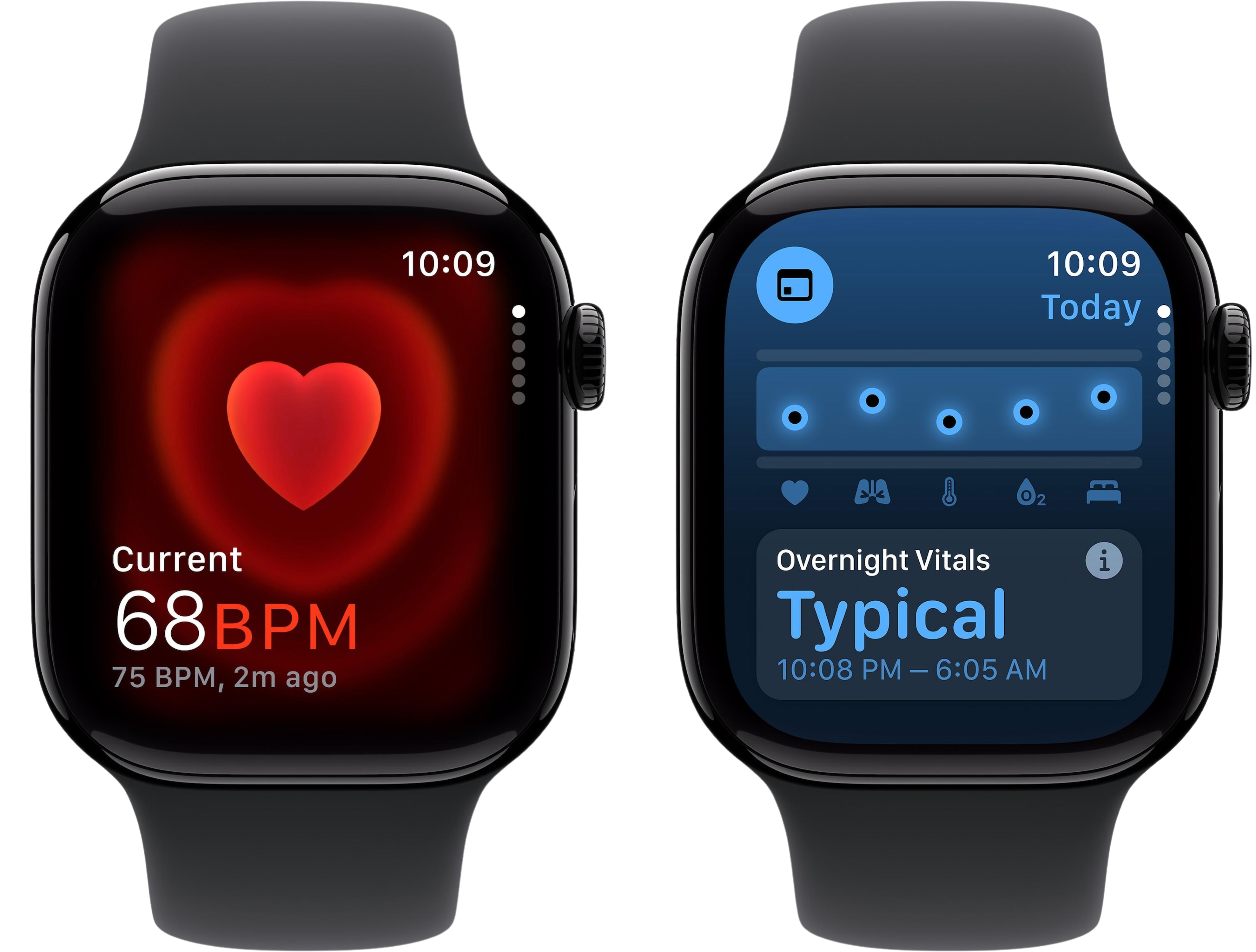 Apple Watch Series 10